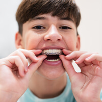 ortho-clear-aligners boy putting clear aligners onto his teeth